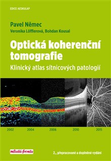 Optická kohereční tomografie - 2. vydání