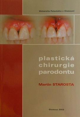 Plastická chirurgie parodontu