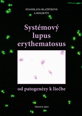 Systémový lupus erythematosus /od patogenézy k liečbe