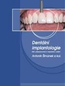 Dentální implantologie, 3. vydání, přepracované a doplněné, 2017