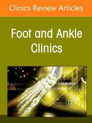 Alternatives to Ankle Joint Replacement, An issue of Foot and Ankle Clinics of North America: Volume