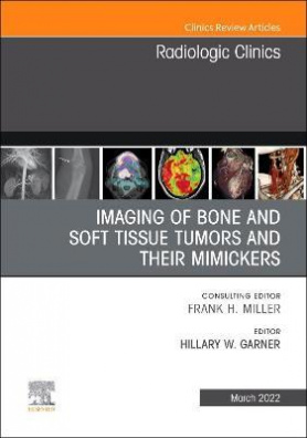 Imaging of Bone and Soft Tissue Tumors and Their Mimickers, An Issue of Radiologic Clinics of North