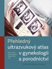 Přehledný ultrazvukový atlas v gynekologii a porodnictví