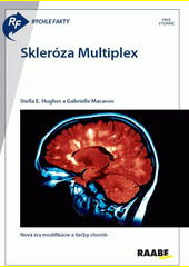 Skleróza Multiplex