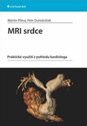 MRI srdce - Praktické využití z pohledu kardiologa
