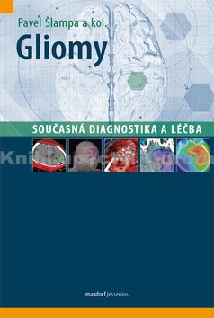 Gliomy. Současná diagnostika a léčba