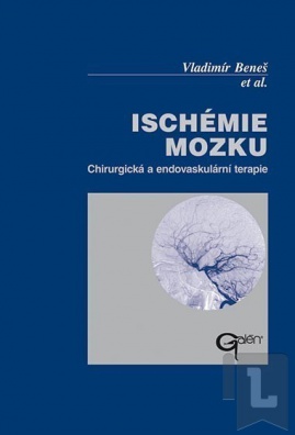 Ischémie mozku - Chirurgická a endovaskulární terapie